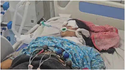 बीकानेर PBM अस्पताल में सिजेरियन के बाद 6 महिलाओं की हालत बिगड़ी, वीडियो में देंखे किडनी फेल; ICU में भर्ती, एक वेंटिलेटर पर