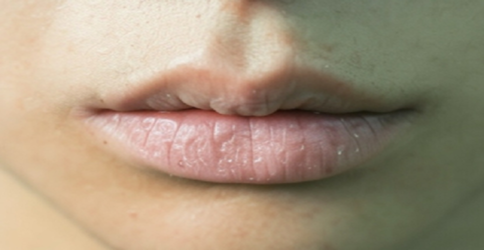 फटे होंठ से लेकर झुर्रियों तक, इन चीजों को वैसलीन में मिलाकर उपयोग करने से मिलेगा आराम