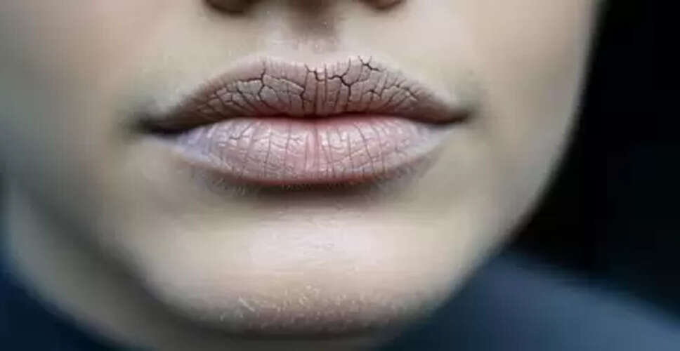 मुंह सूखना सिर्फ डिहाइड्रेशन नहीं, गंभीर रोगों का संकेत भी, आयुर्वेद से जानें समाधान