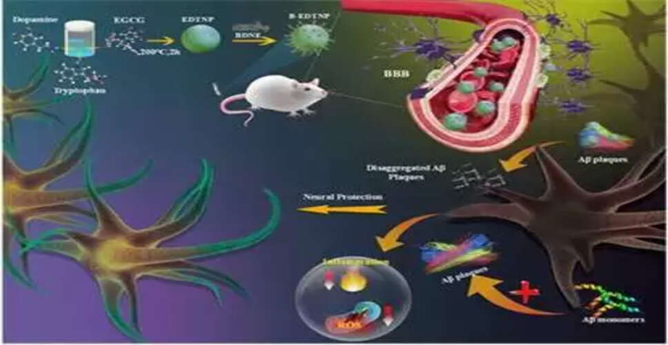 मोहाली के वैज्ञानिकों ने ग्रीन टी से बनाई नैनोपार्टिकल दवा, अल्जाइमर के लक्षणों पर करेगी एक साथ वार