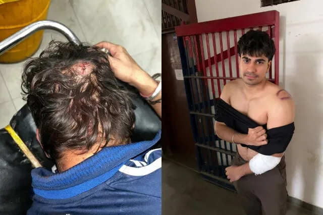 जयपुर: मालवीय नगर के क्लब में बर्थडे पार्टी के दौरान बवाल, MBBS छात्रों पर बाउंसरों का हमला, 10 घायल