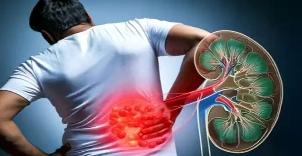 आप भी तो नहीं दे रहे किडनी स्टोन को दावत? आयुर्वेद से जानें बचाव का आसान तरीका