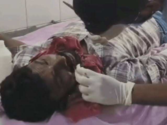 डूंगरपुर में शादी के दौरान बवाल, बारात का रास्ता रोकने पर झड़प; एक्सक्लूसिव फुटेज में देंखे युवक के 6 दांत टूटे