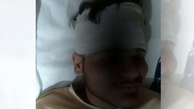 जोधपुर के सरकारी स्कूल में खूनी खेल, बहन पर टिप्पणी को लेकर छात्रों में हुई झड़प... सिर पर गंभीर चोट