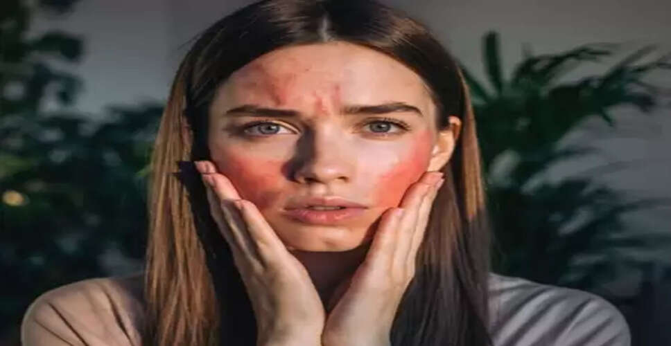 सर्द मौसम और आहार की कमी का संकेत देते हैं फटे गाल, इन उपायों से मिलेगी राहत