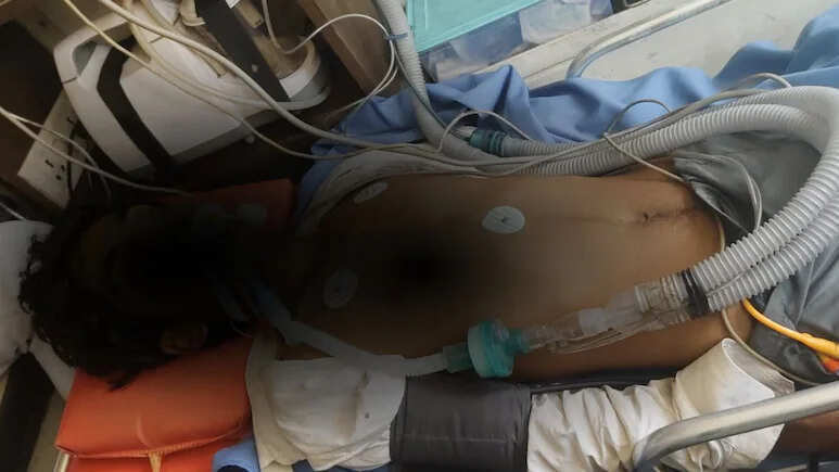 भिवाड़ी में पुलिस बर्बरता पर बवाल: नाबालिग दलित बालक वेंटिलेटर पर, थाना प्रभारी सहित 4 पुलिसकर्मियों पर FIR