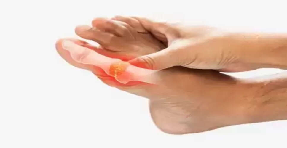 'आम' है गठिया की मुख्य वजह, आयुर्वेद से जानें बचाव का तरीका