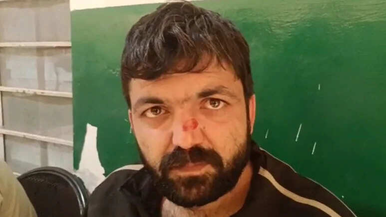 बीजेपी के पूर्व मंत्री के बेटे ने यूथ कांग्रेस प्रदेश सचिव को पीटा, शराब के पैसे नहीं देने पर किया हमला