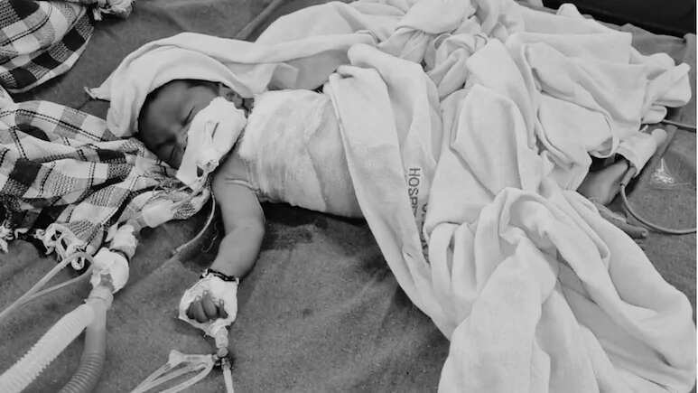 कुत्तों के हमले में घायल बच्चे की मौत, अस्पताल में वेंटिलेटर पर चल रहा था इलाज