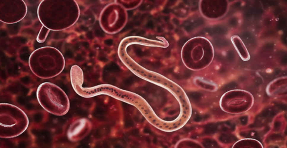 बार-बार गैस बनना हो सकता है खतरे का संकेत, इंटेस्टाइनल वर्म इन्फेक्शन को न करें नजरअंदाज