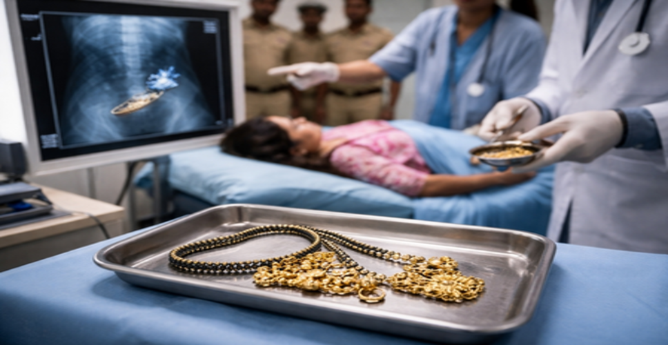 मध्य प्रदेश : महिला चोर गिरोह राजस्थान में गिरफ्तार, एक्सरे के दौरान पेट में मिले चोरी के गहने