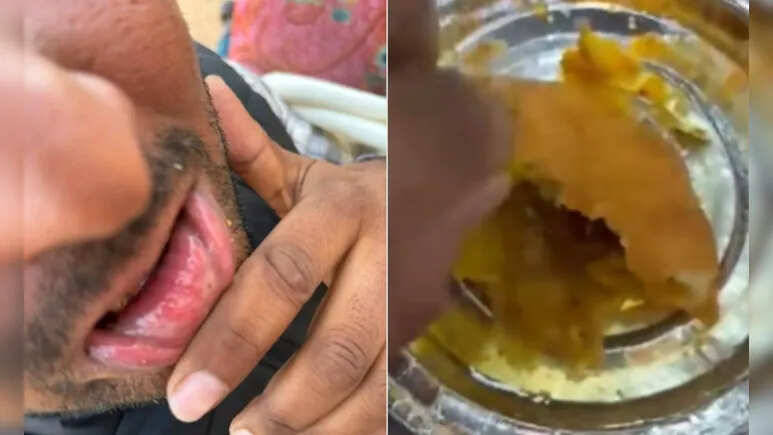 जोधपुर मिष्ठान भंडार की कचौरी में निकली ब्लेड, कोटपूतली में युवक का होंठ कटा