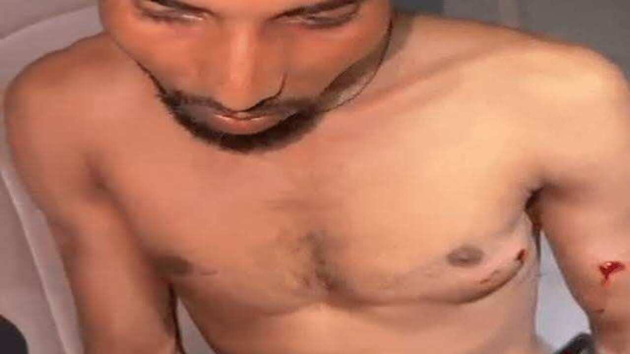 डीग में गहने लूटने के बाद बदमाशों ने गांव में की ताबड़तोड़ फायरिंग, फुटेज में देंखे युवक के शरीर में लगे छर्रे