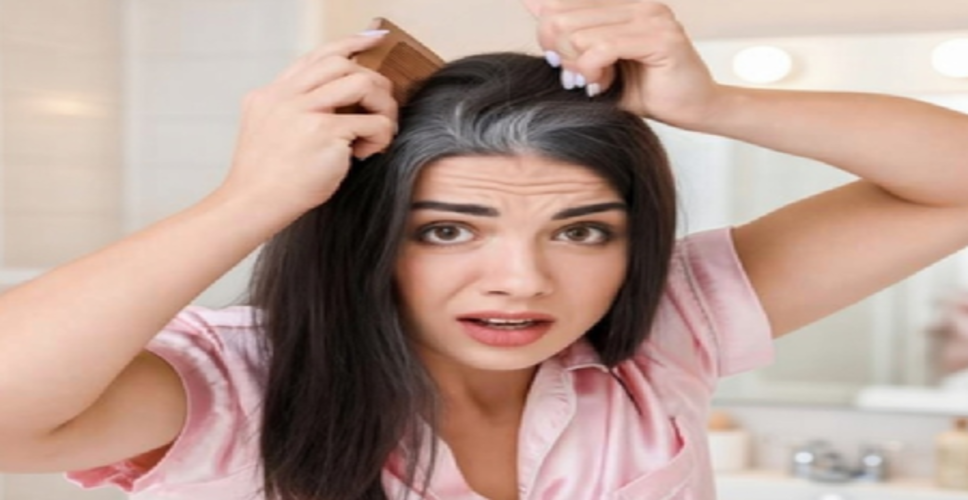 पित्त दोष के असंतुलन से सफेद बालों की परेशानी, जानें कारण से लेकर उपाय