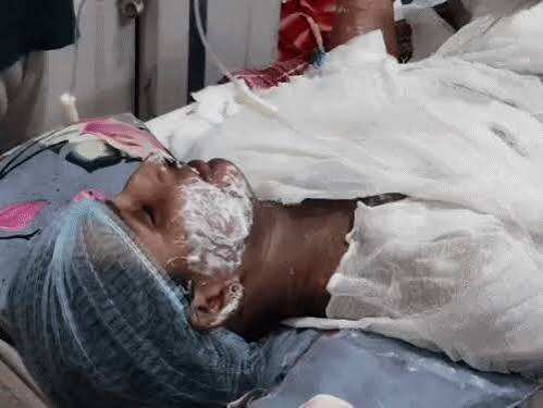 टीवी बेचने को लेकर पति-पत्नी में विवाद, वीडियो में जाने महिला को आग लगाने का आरोप; 60% झुलसी