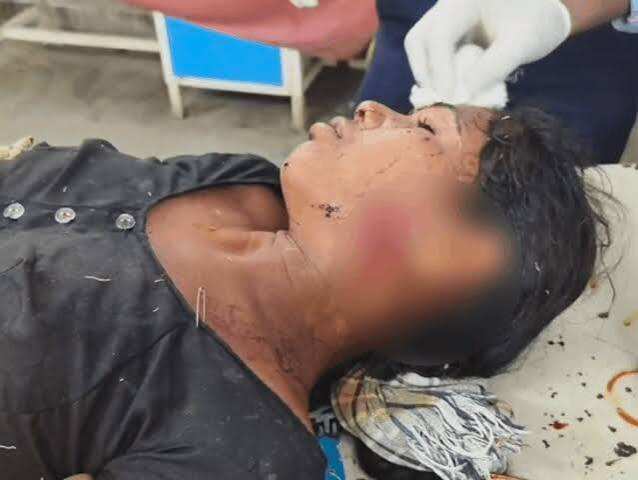 डूंगरपुर में लेपर्ड का आतंक, एक घंटे में दो महिलाओं पर हमला; फुटेज में देंखे एक की हालत गंभीर, गांव में दहशत