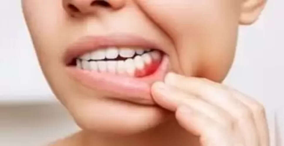 दांतों में तेज झनझनाहट और दर्द, इन घरेलू नुस्खों से मिलेगा छुटकारा