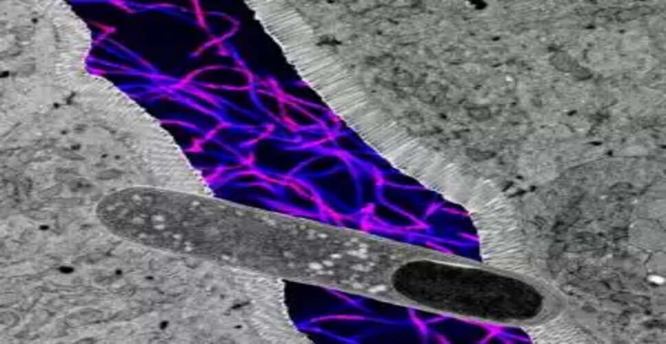 अमेरिकी वैज्ञानिकों ने ढूंढ निकाला ऐसा गट बैक्टीरिया जो वजन कम करने में भी मददगार