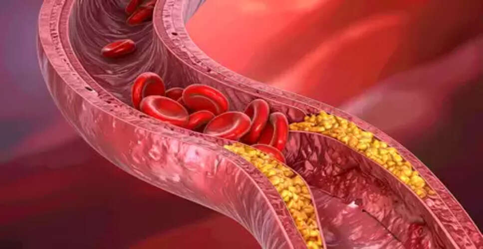 कोलेस्ट्रॉल शरीर के लिए जरूरी, सिर्फ इसकी अधिकता खतरनाक