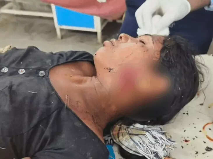 लेपर्ड ने एक घंटे में दो महिलाओं पर किया हमला, एक की हालत गंभीर; हमले के बाद जंगल में भागा