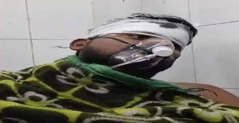 Alwar इंस्टाग्राम पर कहासुनी के बाद बदमाशों ने घर में घुसकर युवक पर किया चाकू से हमला