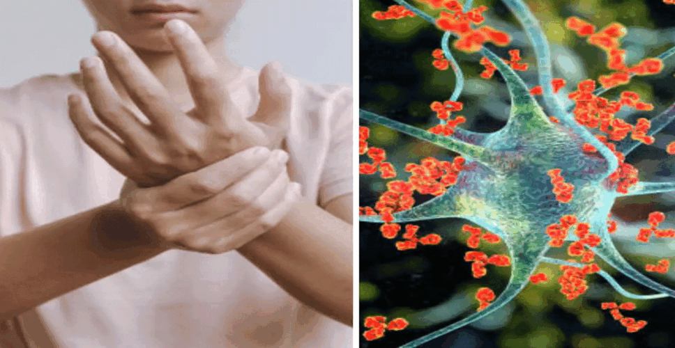 राजस्थान के इस जिले में पाए गए सबसे अधिक GBS सिंड्रोम के मरीज, जानिए क्या है इस वायरस के लक्षण और कैसे करता है असर ? 