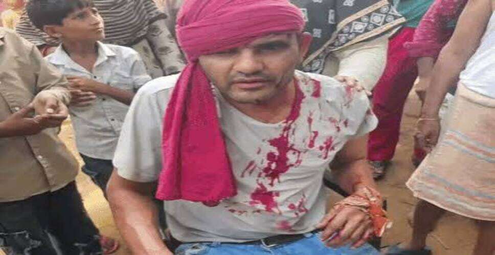 अलवर में निर्दलीय पार्षद के 2 समर्थकों को पीटा, BJP की बाड़ेबंदी में जाने को लेकर हुआ विवाद