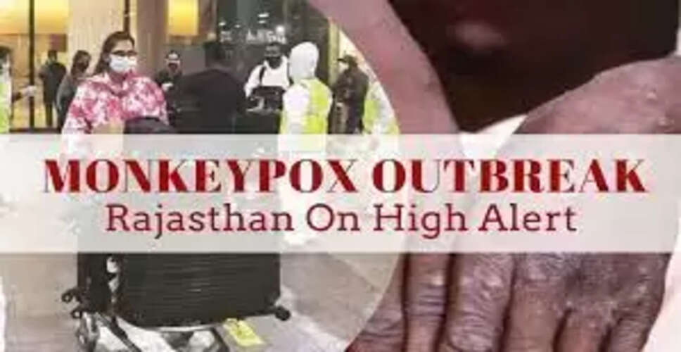 Rajasthan Breaking News: विश्व में मंकी पॉक्स का बढ़ती खतरा, राजस्थान सीएमएचओ को किया गया अलर्ट
