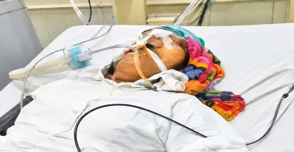 बीकानेर पीबीएम अस्पताल में प्रसूताओं की हालत में सुधार, एक महिला को मिली छुट्टी, दो अब भी गंभीर