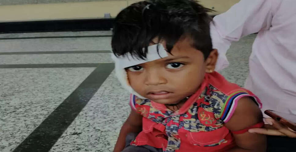 Pali&nbsp;&nbsp;में 5 साल के बच्चे को बुरी तरह पीटा, हालत गंभीर&nbsp;