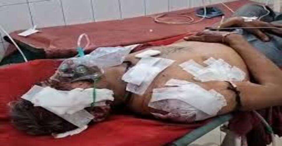 पाली में ट्रक और डंपर की आमने-सामने टक्कर, दो घायल; चालक की हालत गंभीर