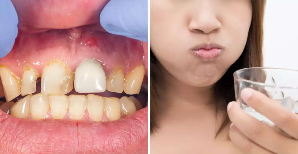 दांत साफ करते वक्त चली गई जान, दुल्हन बनने वाली थी, जाने पूरा मामला&nbsp;