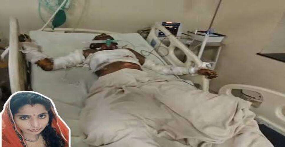 शादी के 14 साल बाद विवाहिता को पेट्रोल डालकर जलाने का आरोप, 90 फीसदी झुलसी महिला की मौत; पति समेत 4 गिरफ्तार
