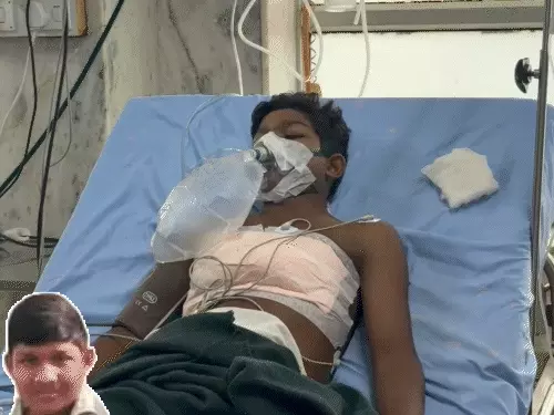 डूंगरपुर में 8वीं के छात्र के सीने में घुसा तीर, तीरंदाजी अभ्यास के दौरान हुआ हादसा