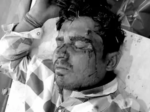 सड़क हादसे में सरकारी शिक्षक की मौत, तेज रफ्तार बाइक की टक्कर से सिर में गंभीर चोट; मौके पर तोड़ा दम