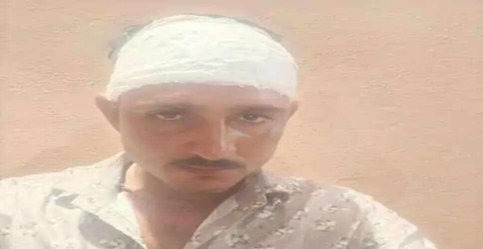 Ajmer में होटल पर कोल्ड ड्रिंक पीने आए युवकों ने रुपए मांगने पर लकड़ी के फंटो से वार कर संचालक को गंभीर रूप से घायल कर दिया 