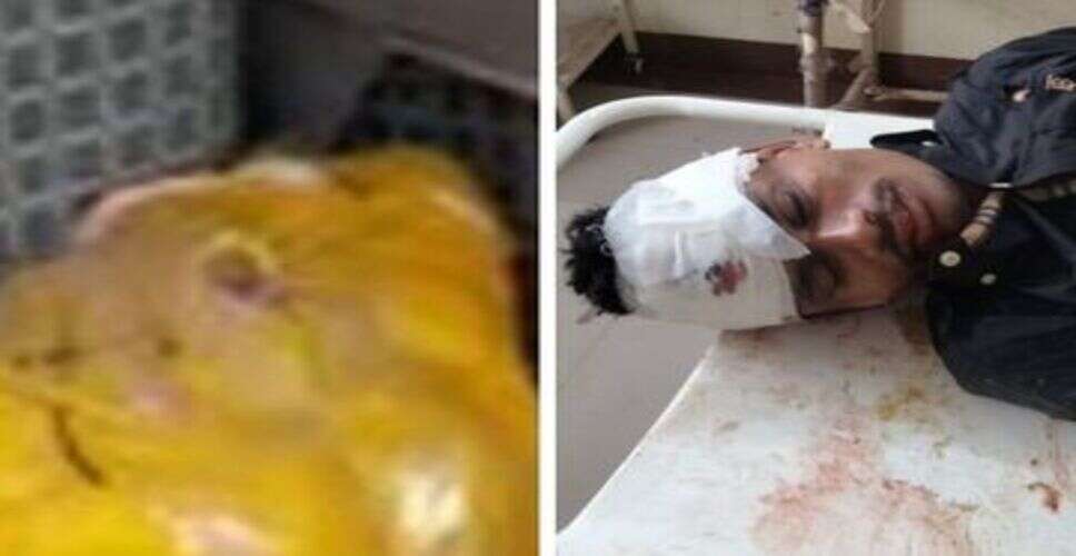 बीकानेर में सड़क हादसे के बाद बड़ा खुलासा, घायल युवक की स्कूटी से 70 करोड़ की हेरोइन बरामद