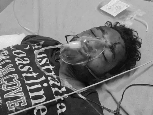 ट्रेन से युवक के पैर कटे, खून के लिए तड़पता रहा; ब्लड बैंक में 3 घंटे तक कमरा खटखटाता रहा साथी, स्टाफ का अता-पता नहीं
