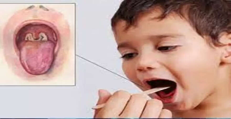 Karoli&nbsp;नहीं थम रहा डिप्थीरिया का प्रकोप, हर दिन आ रहे 2-3 मरीज