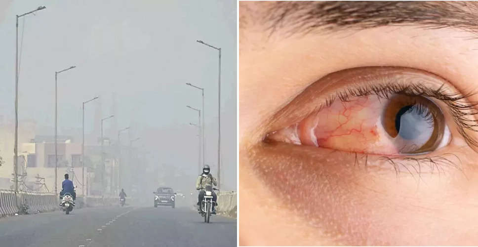 Alwar में जहरीली हवा के कारण त्वचा और आंखों में जलन के मरीज बढ़ रहे हैं