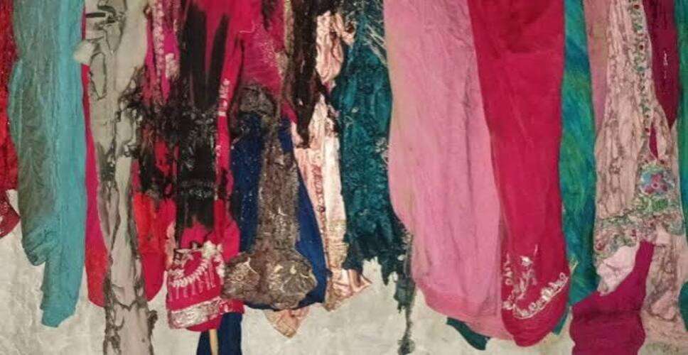 श्रीगंगानगर में पति ने पेट्रोल डालकर पत्नी को जलाया, 80% झुलसी महिला की मौत; चरित्र पर करता था शक