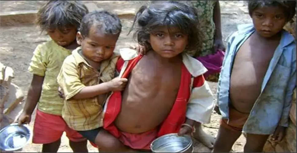 उदयपुर में कुपोषण प्रबंधन शिविर, जसौता शिविर में 16 कुपोषित बच्चे मिले